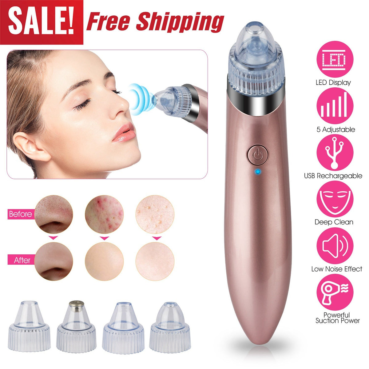 Electric Blackhead Remover Vacuum Suction Facial Pore Cleaner Acne Pimple Extractor Skin Care Cleaning Tool with 4 Suction Head