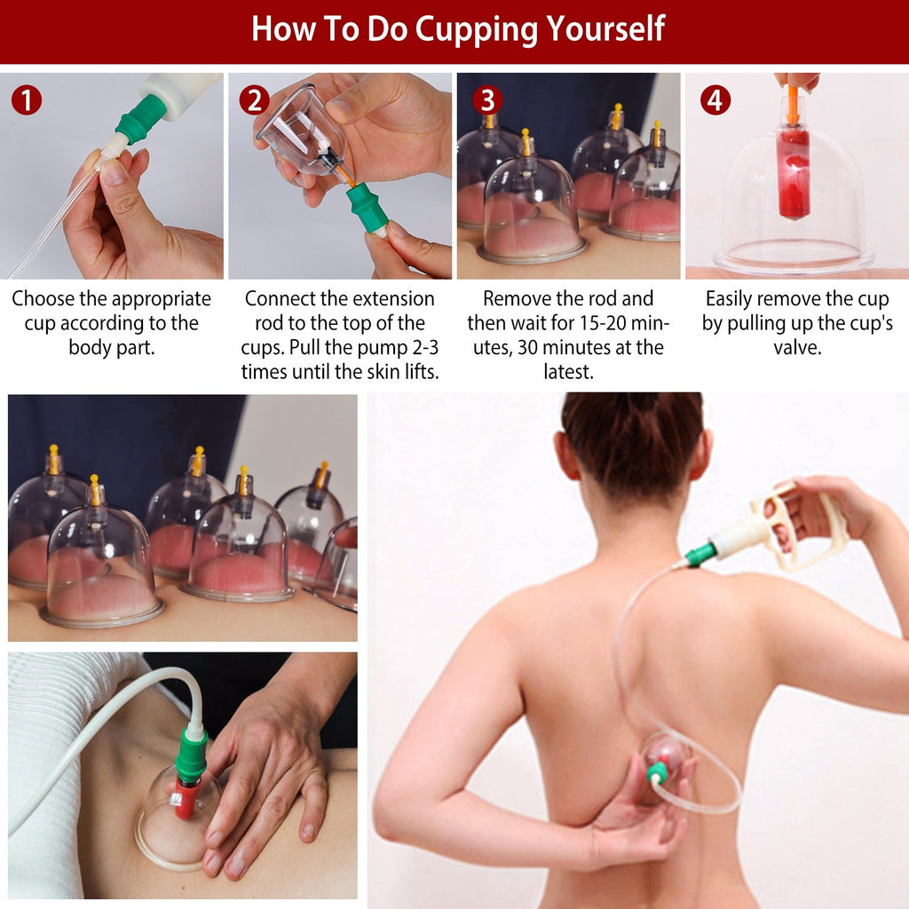 32 Cups Chinese Massage Therapy Cupping Set Body Vacuum Suction Kit Acupoint Massage Kit