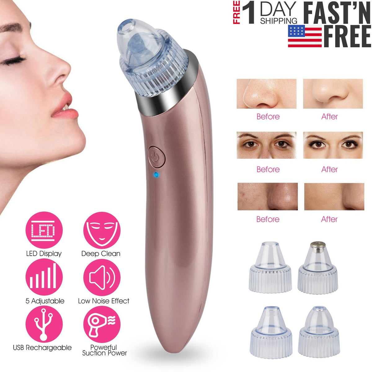 Electric Blackhead Remover Vacuum Suction Facial Pore Cleaner Acne Pimple Extractor Skin Care Cleaning Tool with 4 Suction Head